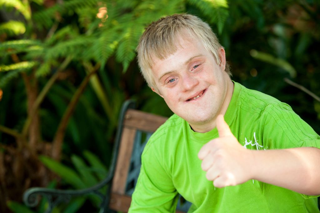 Cute handicapped boy showing thumbs up outdoors.